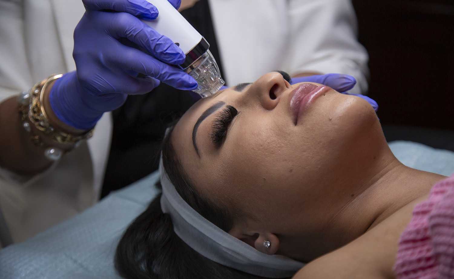 Benefits of Microneedling