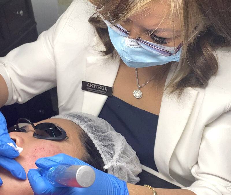 Face and Neck Microneedling