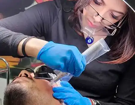 Microneedling Scar Reduction Service