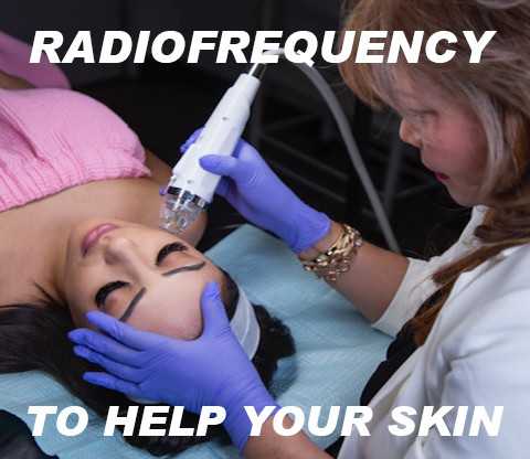 Questions and Answers for Radiofrequency Treatment